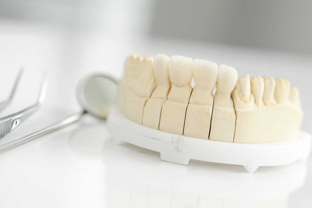 差し歯(被せ物)が原因の口臭とその改善方法